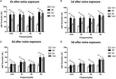 Ginsenoside Rd Ameliorates Auditory Cortex Injury Associated With Military Aviation Noise-Induced Hearing Loss by Activating SIRT1/PGC-1α Signaling Pathway